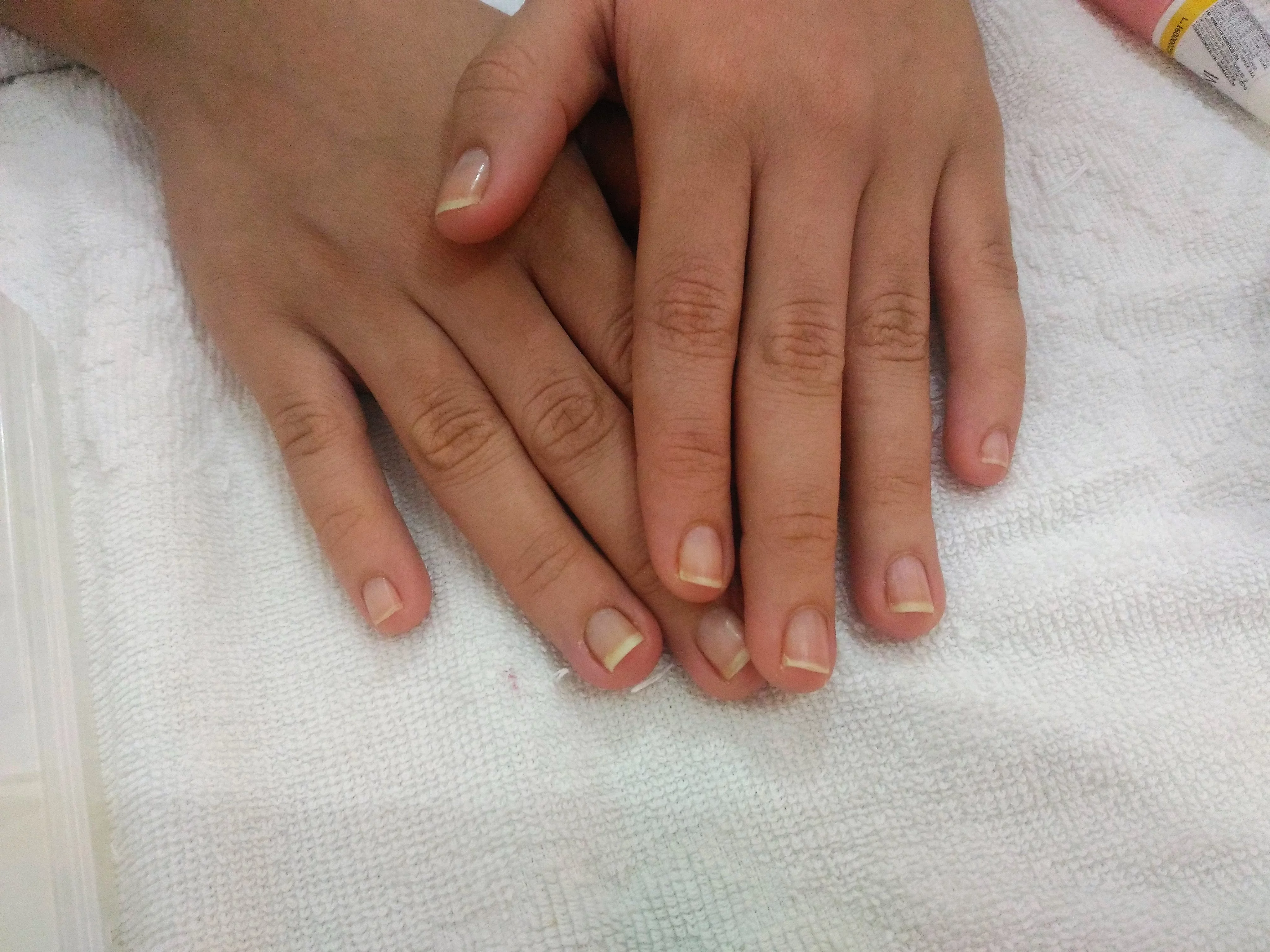 antes das unhas de gel P 20170418 141515 - Ta chick
