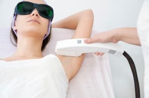 depilação a laser
