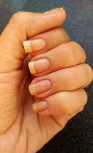 minhas unhas evolução após novos cuidados minhas unhas evolução após novos cuidados